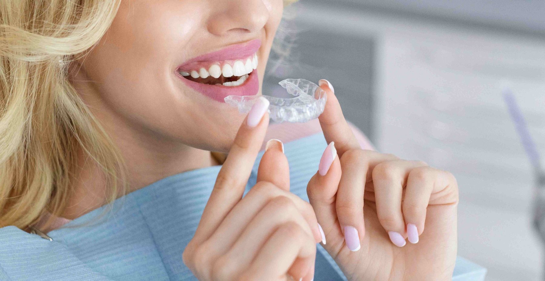 Invisalign in Alpharetta: Timeline, Cost, and Who It&rsquo;s Right For