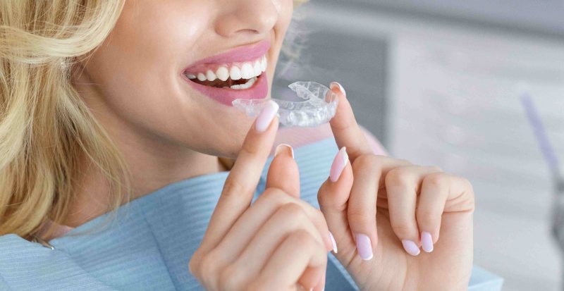 Invisalign in Alpharetta: Timeline, Cost, and Who It&rsquo;s Right For